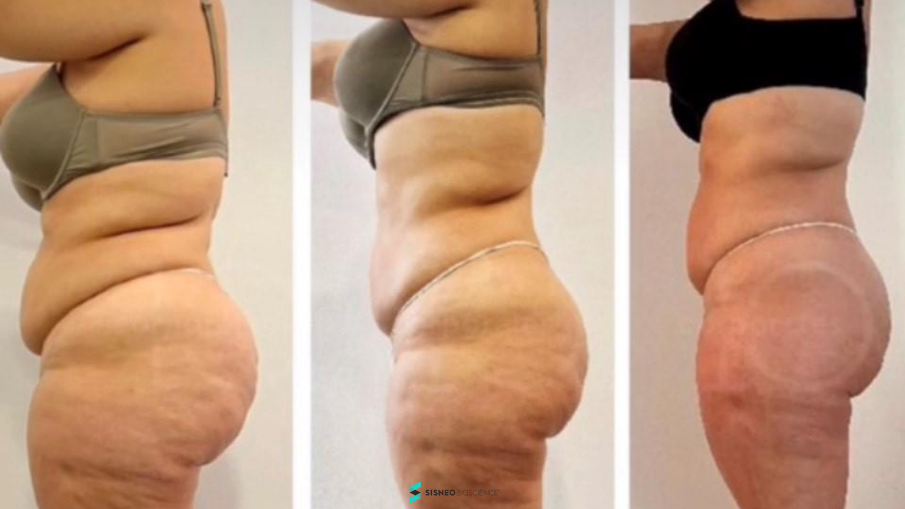 Resultado reafirmación